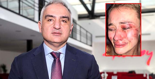 Mehmet Nuri Ersoy... UKRAYNALI MODELİN DAYAK YEMESİ OLAYINA EL KOYDU!