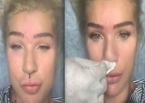 Seda Sayan... ESTETİK OPERASYONUNU CANLI YAYINLADI!