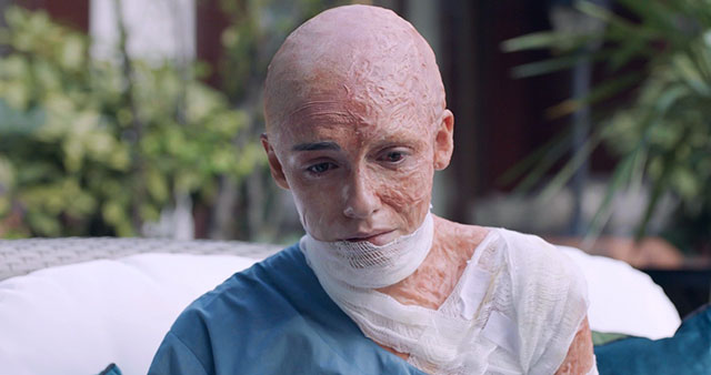 Alev Alev...SARNIÇTAKİ YANGINDAN SONRA HER ŞEY ALT ÜST OLUYOR!