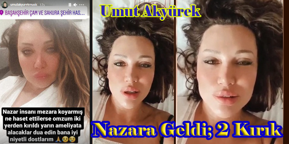 Umut Akyürek... EVİNDE DÜŞTÜ, OMUZUNDA 2 KIRIK VAR!