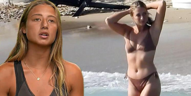 Survivor Aleyna Kalaycıoğlu... BURNUNU YAPTIRDI!