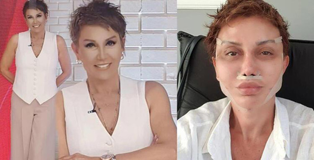 Serap Paköz... İŞTE ESTETİK SONRASI YENİ HALİ!