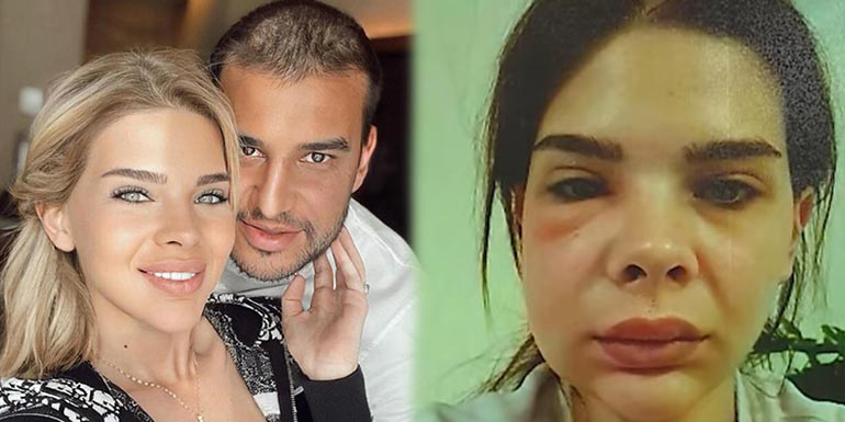 Damla Erşubaşı... 'ODAYA KİLİTLEYİP SALDIRDI!