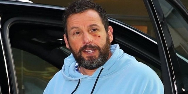 Adam Sandler... YÜZÜNDEKİ MORLUĞUN NEDENİNİ AÇIKLADI!..