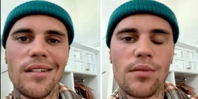 Justin Bieber... DÜNYA TURNESİNİ NEDEN İPTAL ETTİ?