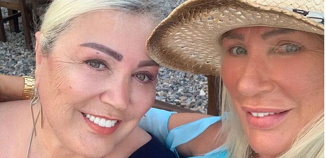 Seda Sayan'ın ablası... HATALI ESTETİK DÜZELTİLDİ, BAMBAŞKA BİRİ OLDU!