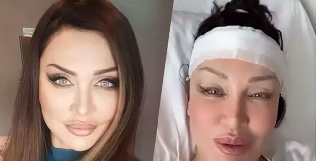 Umut Akyürek... BIÇAK ALTINA YATTI. ALNINI DARALTTI!