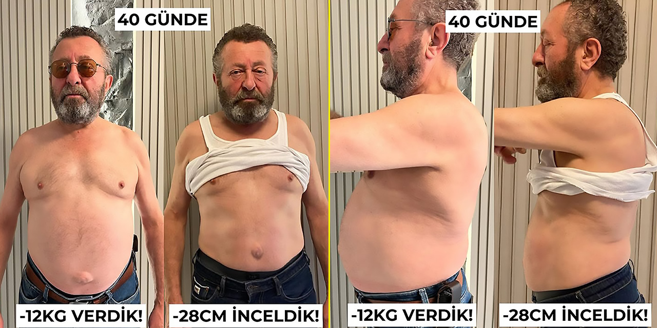 Erkan Can… 40 GÜNDE 12 KİLO VERİNCE UZMANLAR UYARDI; “ÖLÜMCÜL OLABİLİR”