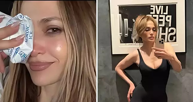 Jennifer Lopez... SUNUCULUK PROVALARINDA YÜZÜNDEN YARALANDI!