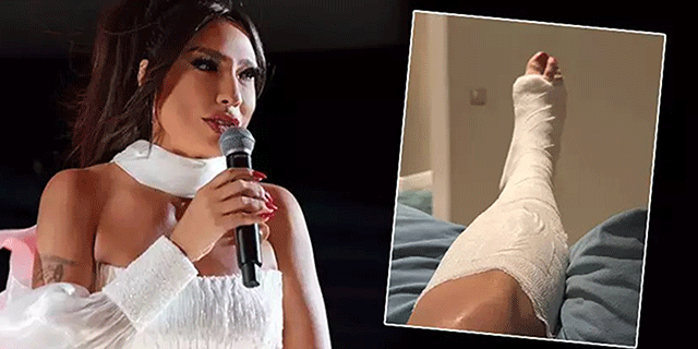 Işın Karaca... TALİHSİZ KAZA, AYAĞI ALÇIYA ALINDI!