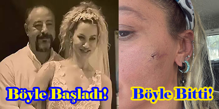 Yıldız Asyalı… EŞİNDEN ŞİDDET GÖRDÜĞÜNÜ AÇIKLADI! BOŞANIYOR