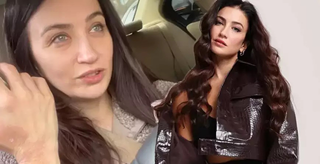 Ceren Benderlioğlu... "EŞREF RÜYA" SETİNDE GÖRÜNMEZ KAZA!..